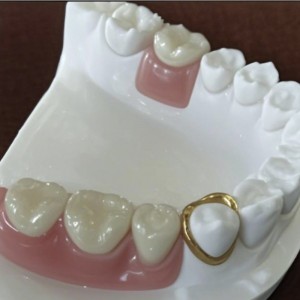 Pontossági rögzítés